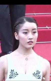 胖妹整容成了美女网红,整容蜕变，成为美女网红的励志传奇